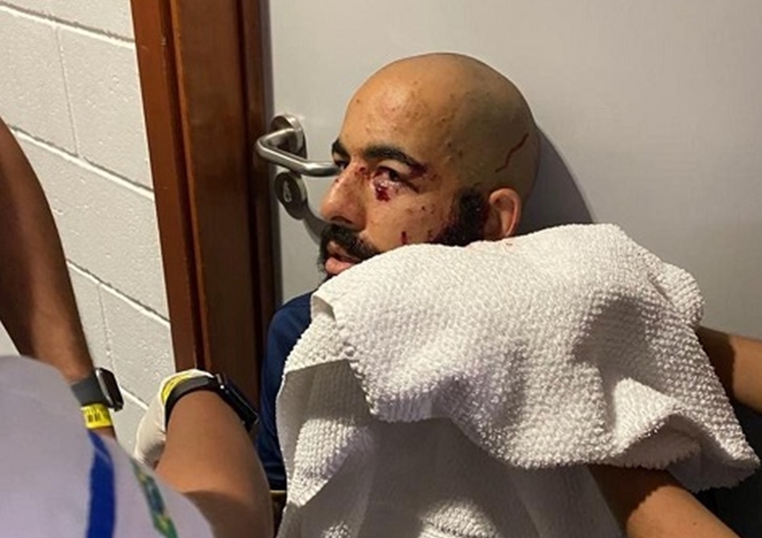 Jogadores do Bahia ficam feridos após ônibus ser atingido por bomba