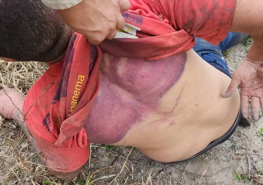 Motorista por aplicativo é sequestrado e torturado por traficantes após ser confundido com informante
