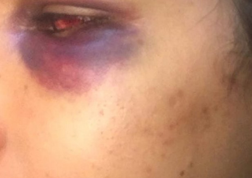 Jovem denuncia agressão de ex-marido filho do prefeito de Salinas da Margarida