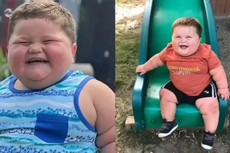 Menino de 3 anos chegou a pesar 45 kg por condição genética rara nos EUA