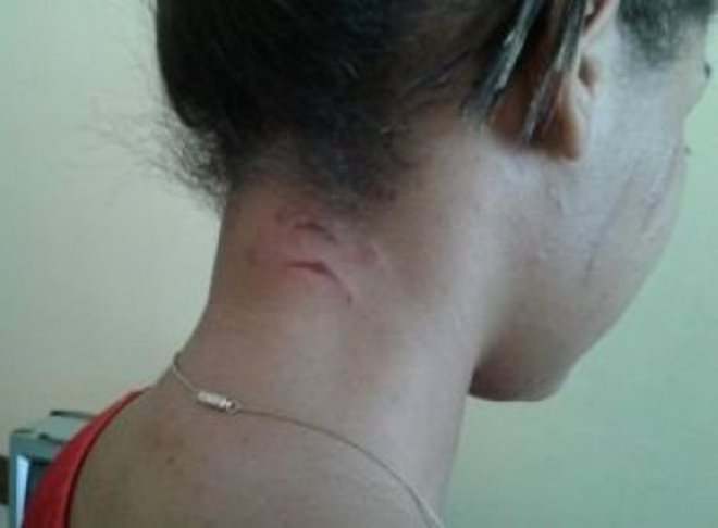 Feira de Santana: Três mulheres agridem e cortam cabelo de jovem
