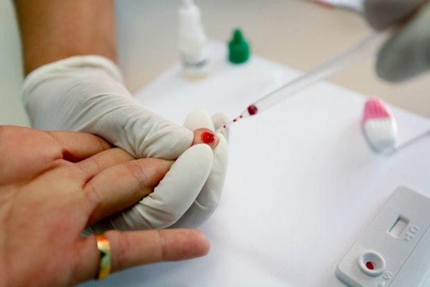 Testes rápidos detectam 21 casos de HIV nos circuitos do carnaval na Bahia