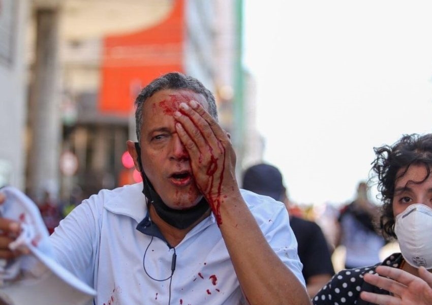 Governo de Pernambuco promete indenizar feridos pela PM em ato contra Bolsonaro