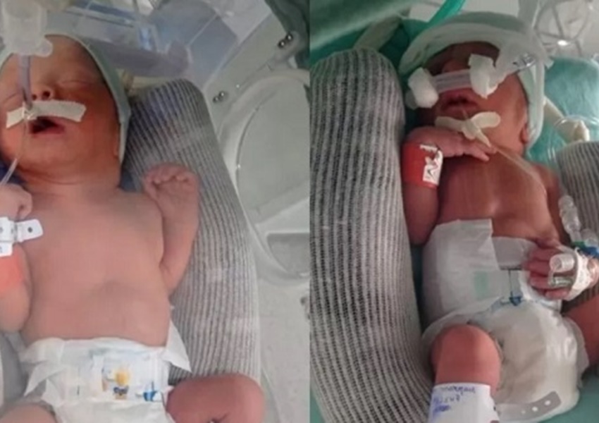 Sem saber que estava grávida, mulher dá à luz gêmeos