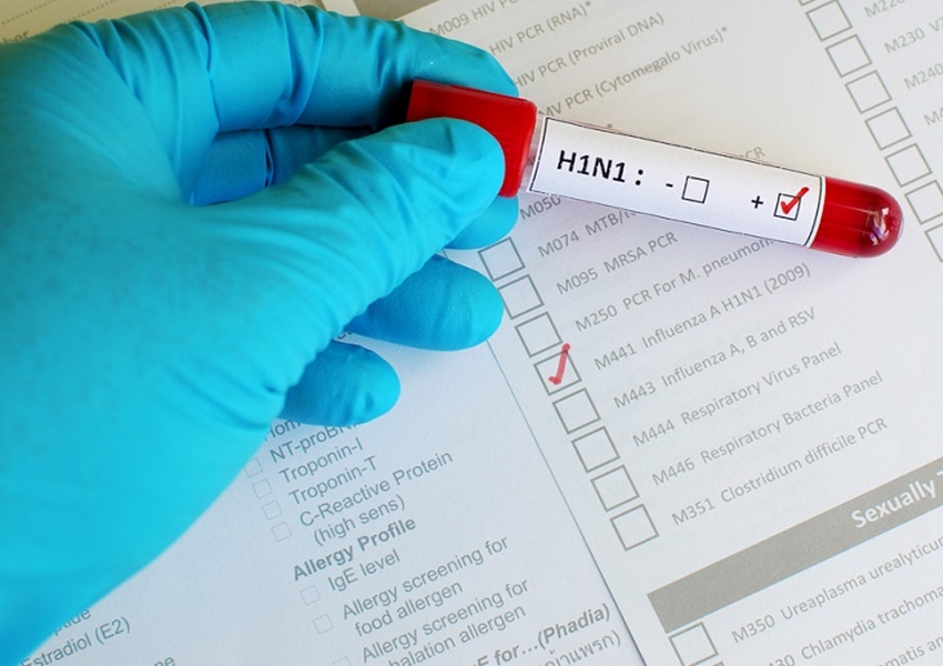 Salvador já registrou 9 mortes por influenza H1N1 apenas este ano