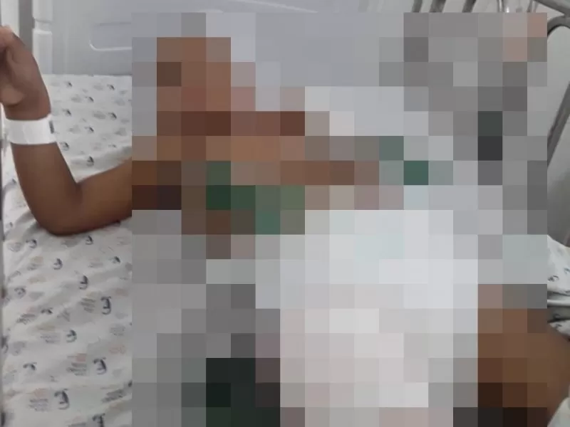 Criança é atropelada por van da prefeitura de Conceição do Coité